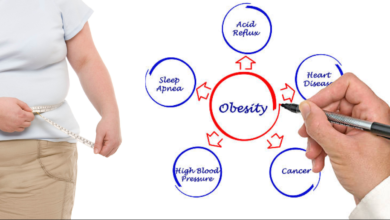 Struggling with Obesity-Related Health Issues?